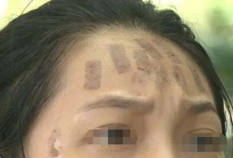 成都光子嫩膚價格，科技重塑肌膚之美